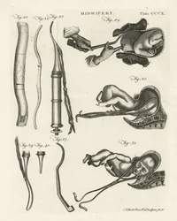 Ostetricia, illustrazione da 